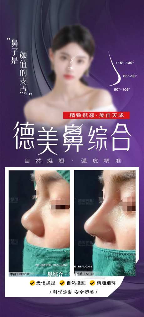 鼻综合案例海报-采灵感-https://www.cailinggan.com/