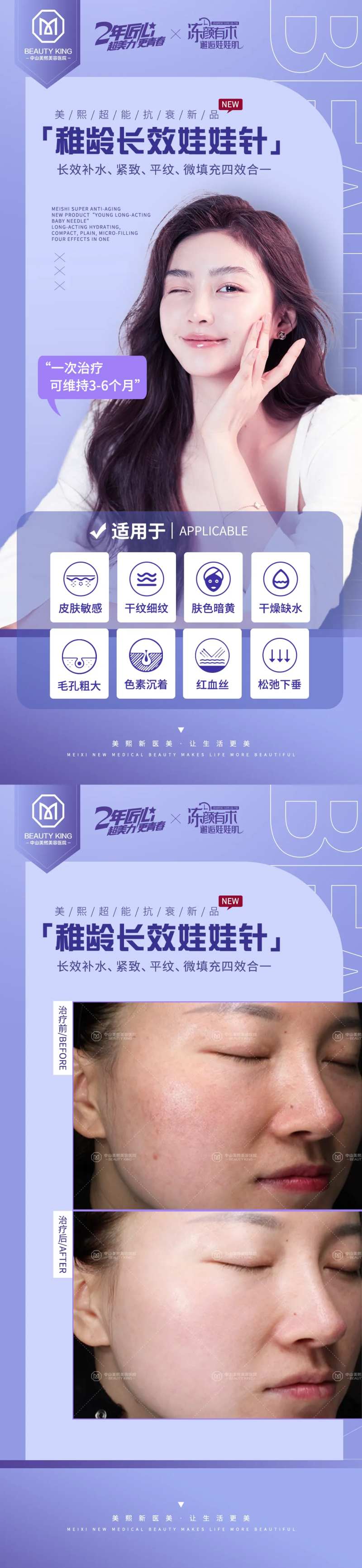 娃娃针适用范围医美海报-采灵感-cailinggan.com