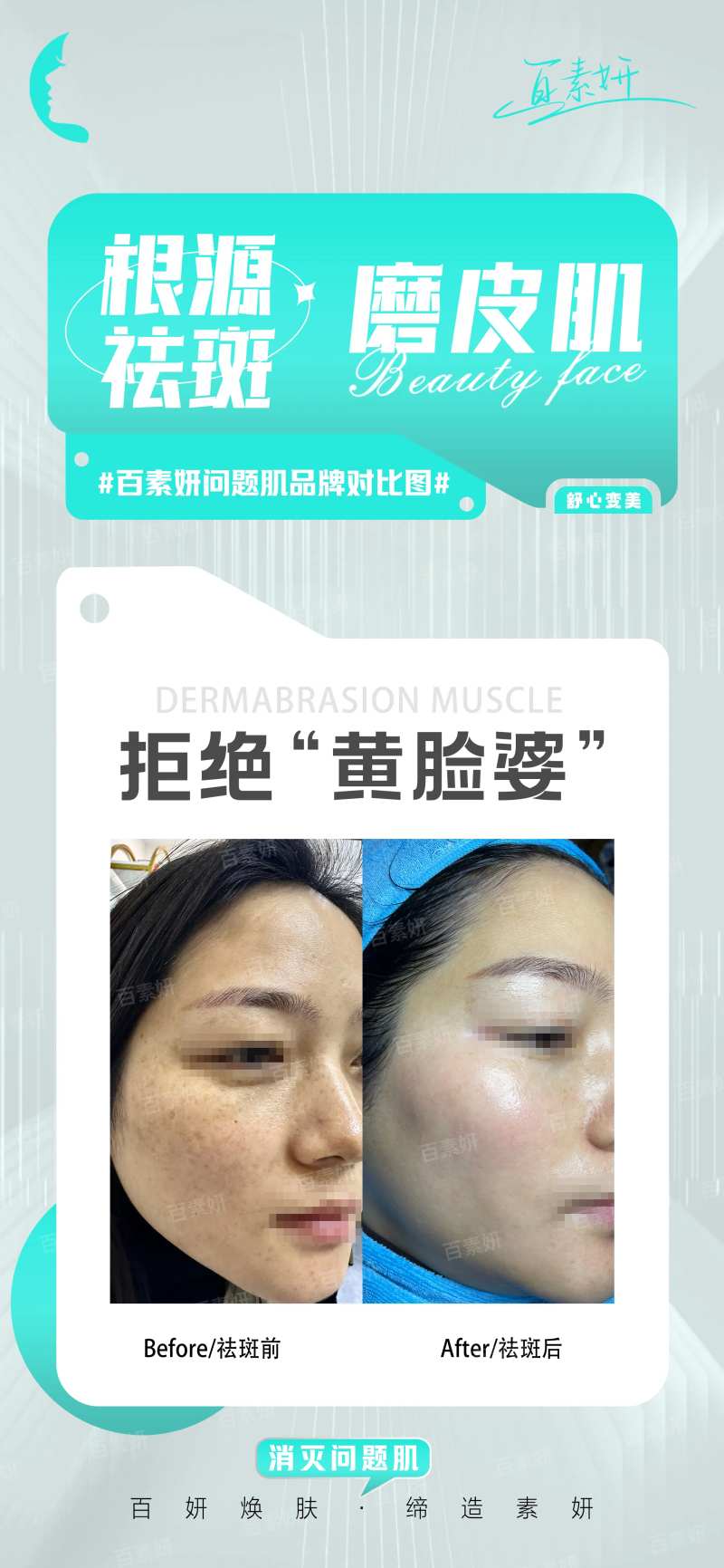 美业产品操作对比图-采灵感-cailinggan.com