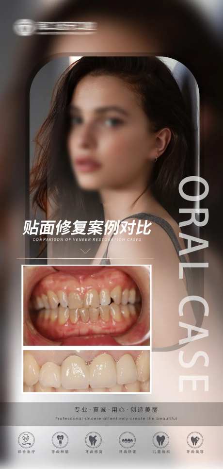 口腔贴面修复移动端海报-采灵感-https://www.cailinggan.com/