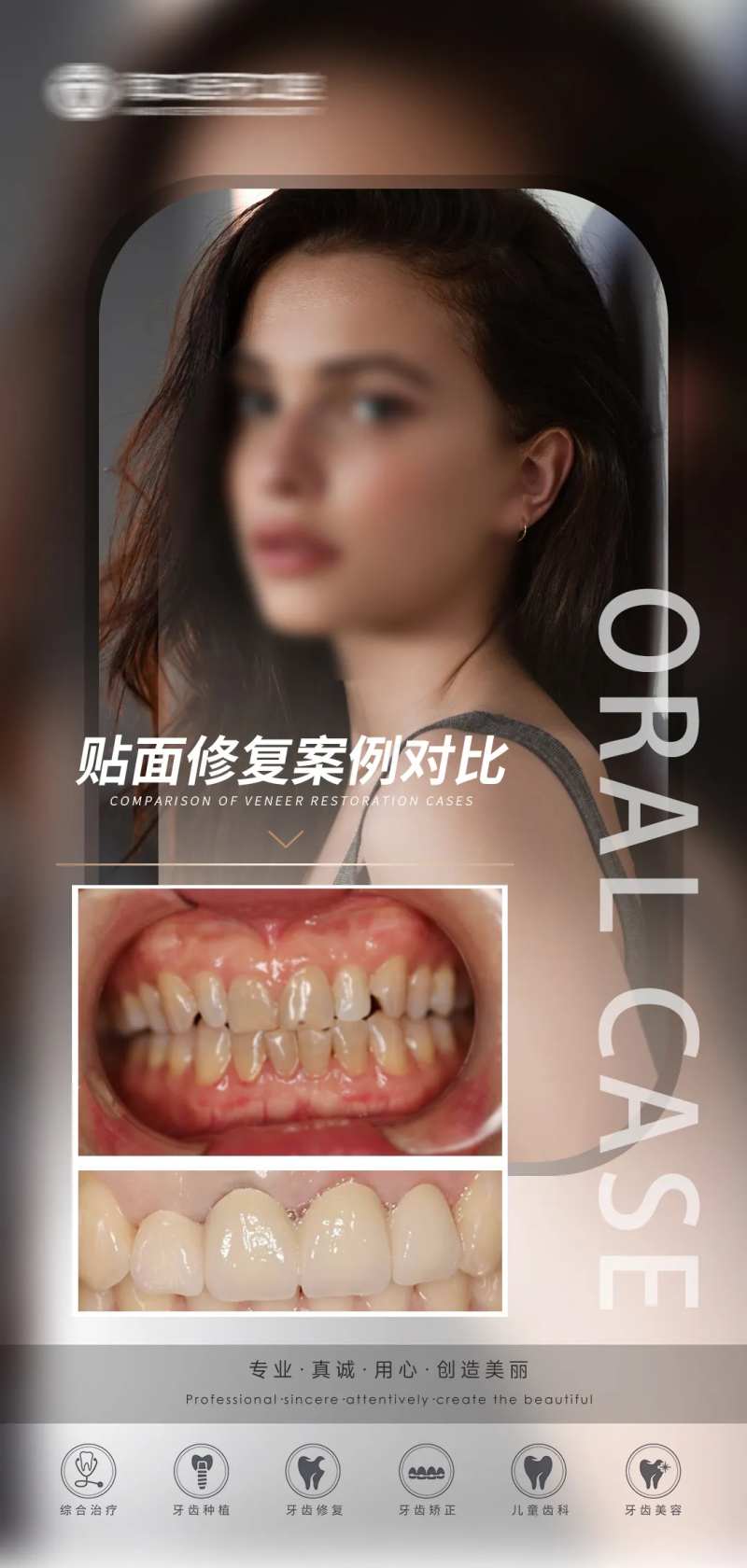 口腔贴面修复移动端海报-采灵感-cailinggan.com