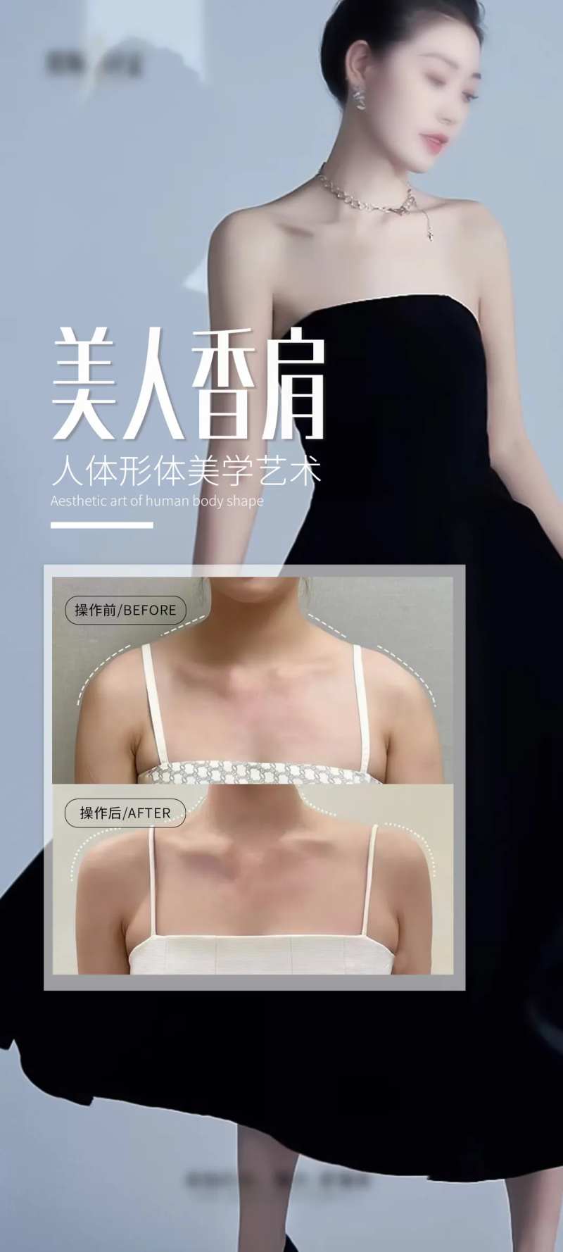 医美美人肩海报-采灵感-cailinggan.com