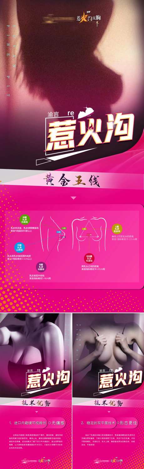 医美胸部项目解析海报-采灵感-https://www.cailinggan.com/