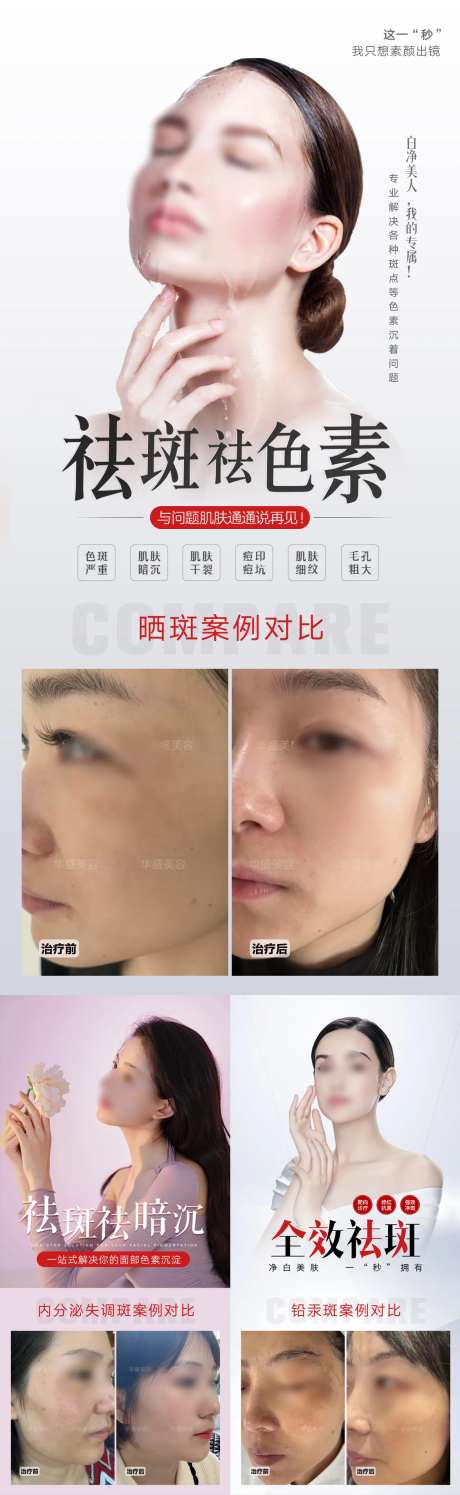 美业祛斑祛痣案例海报-采灵感-https://www.cailinggan.com/
